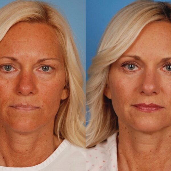 Revitalize Your Look